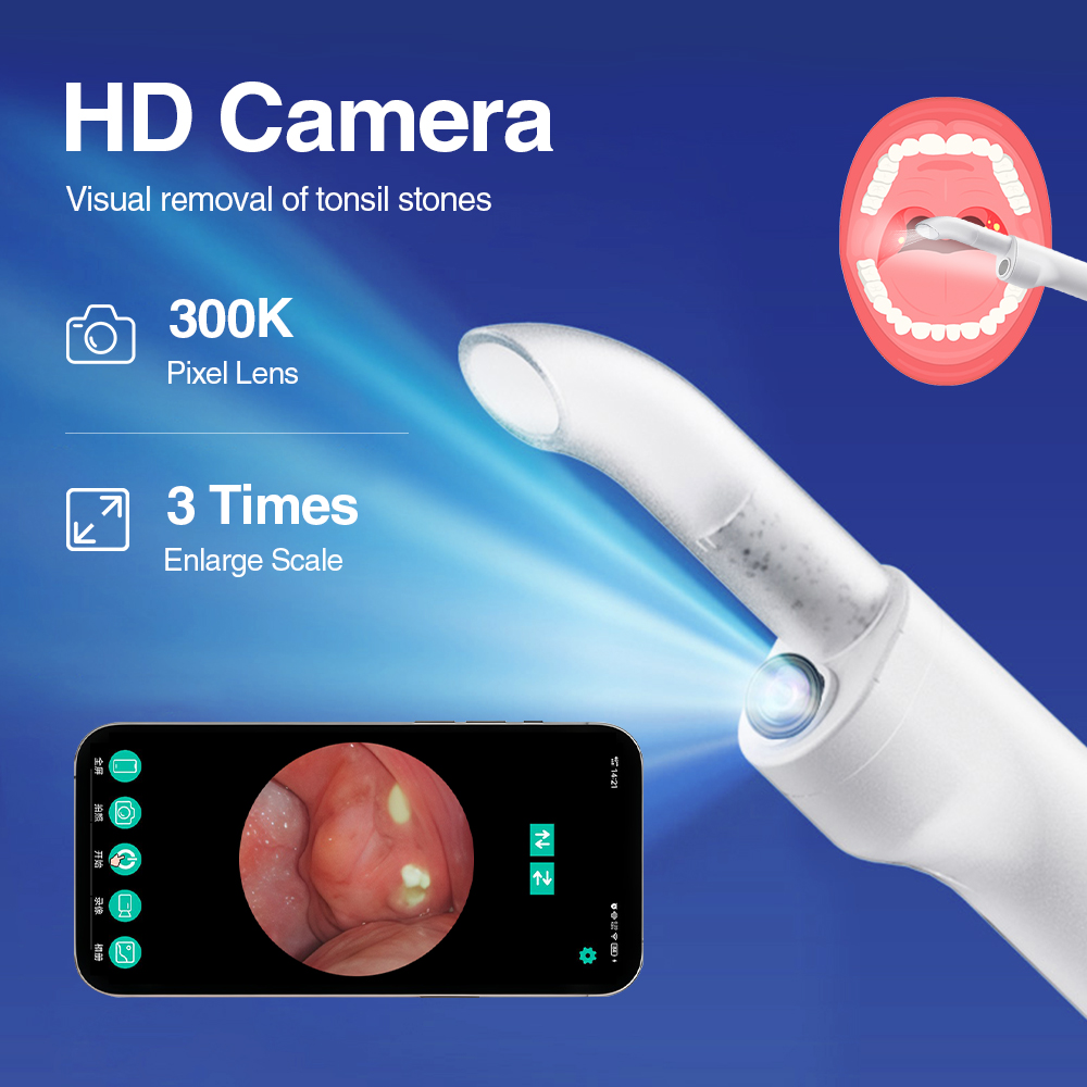 Smart Visual Tonsil Stone Remo - Lighting Visual review and price