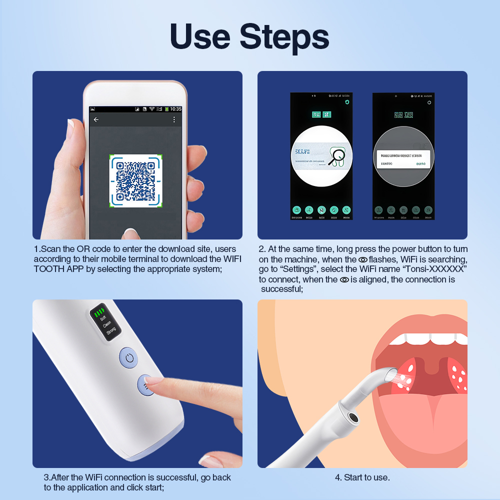 Smart Visual Tonsil Stone Remo - Lighting Visual review and price
