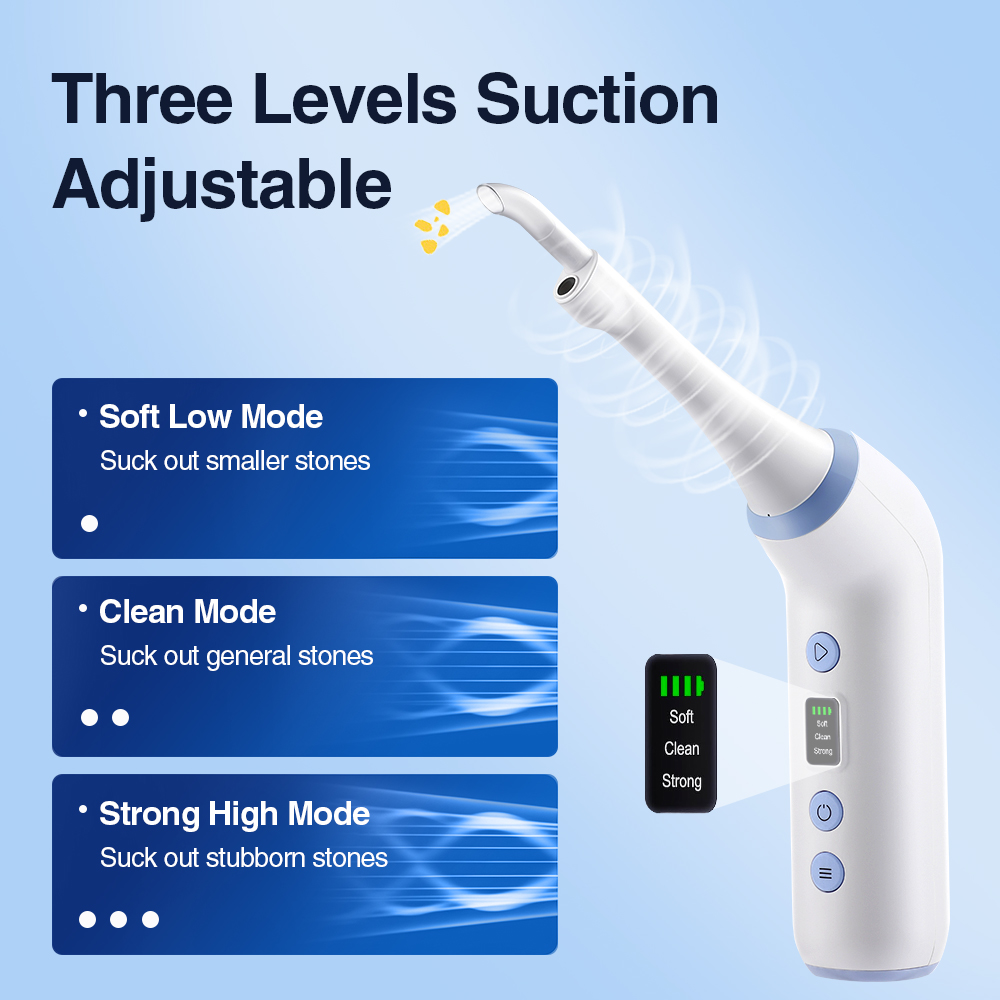 Smart Visual Tonsil Stone Remo - Lighting Visual review and price